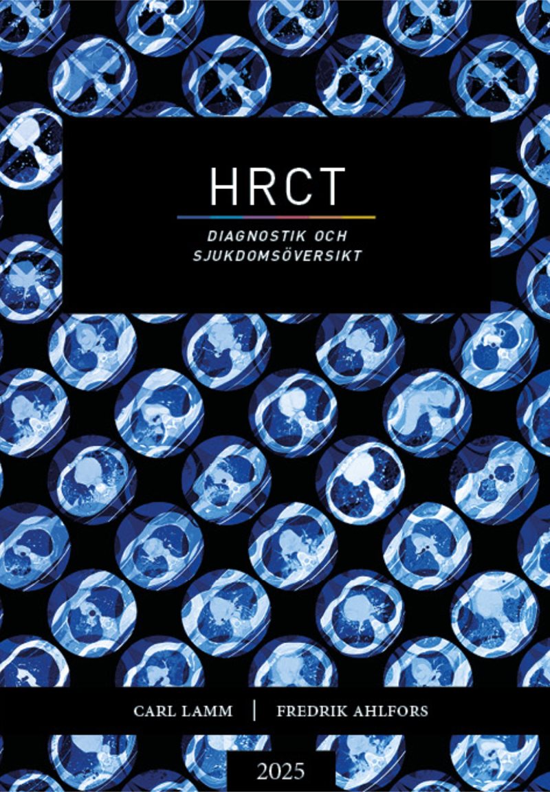 HRCT : diagnostik och sjukdomsöversikt